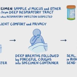 Specimen handling procedures nurseslabs